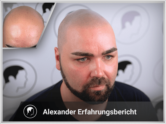 Alexander's Erfahrungsbericht