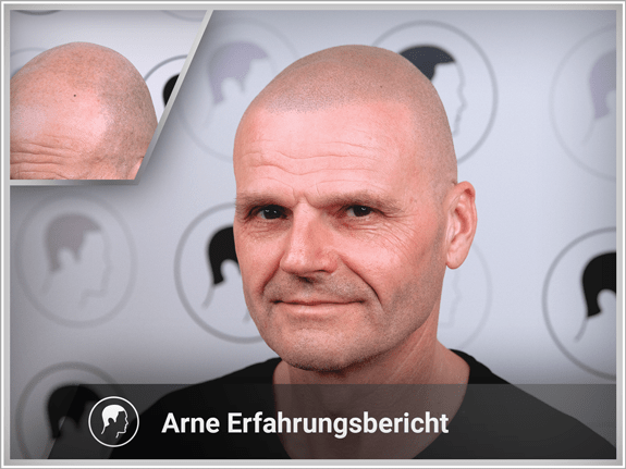 Arne's Erfahrungsbericht