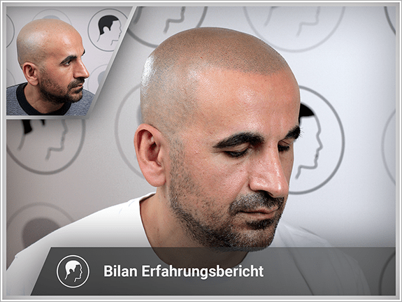 Bilan's Erfahrungsbericht