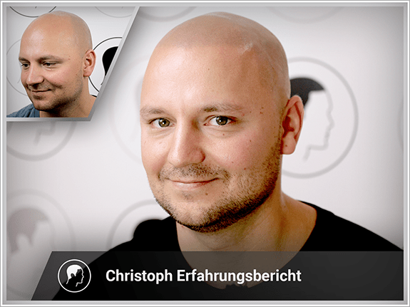 Christoph's Erfahrungsbericht