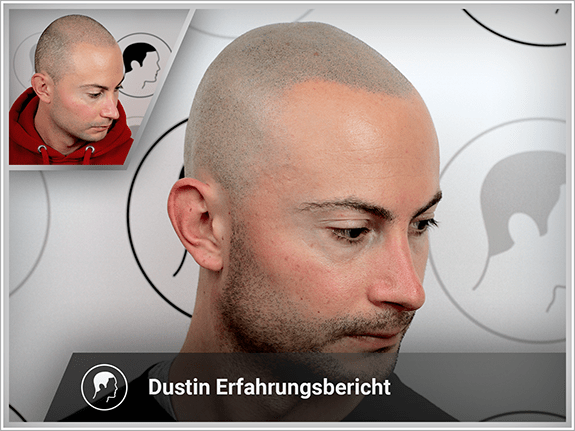 Dustin's Erfahrungsbericht