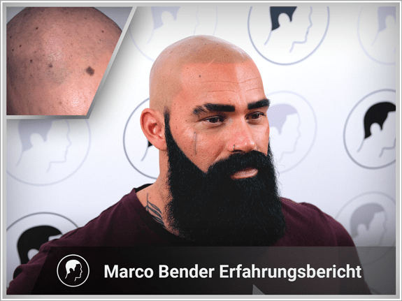 Marco Bender's Erfahrungsbericht
