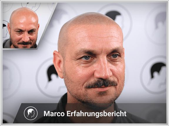Marco's Erfahrungsbericht