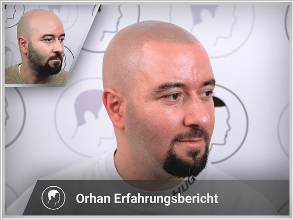 Orhan's Erfahrungsbericht