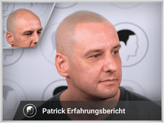 Patrick's Erfahrungsbericht