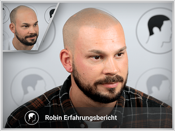 Robin's Erfahrungsbericht