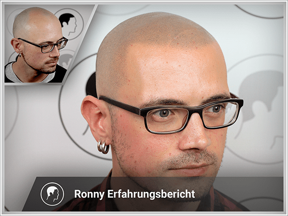 Ronny's Erfahrungsbericht