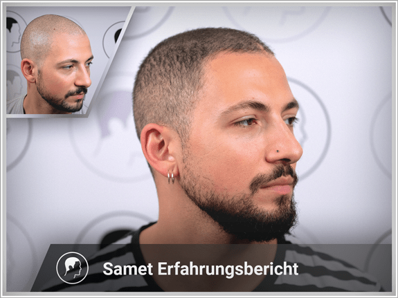 Samet's Erfahrungsbericht