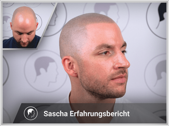 Sascha's Erfahrungsbericht