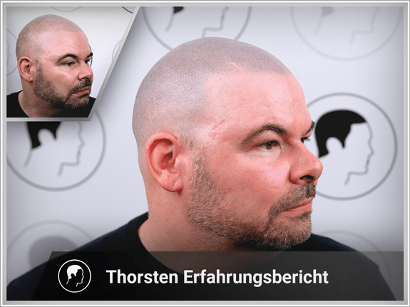Thorsten's Erfahrungsbericht