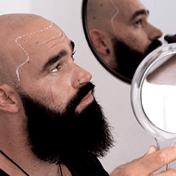 Ein Blick in zwei Spiegel für die neue Haarlinienpigmentierung