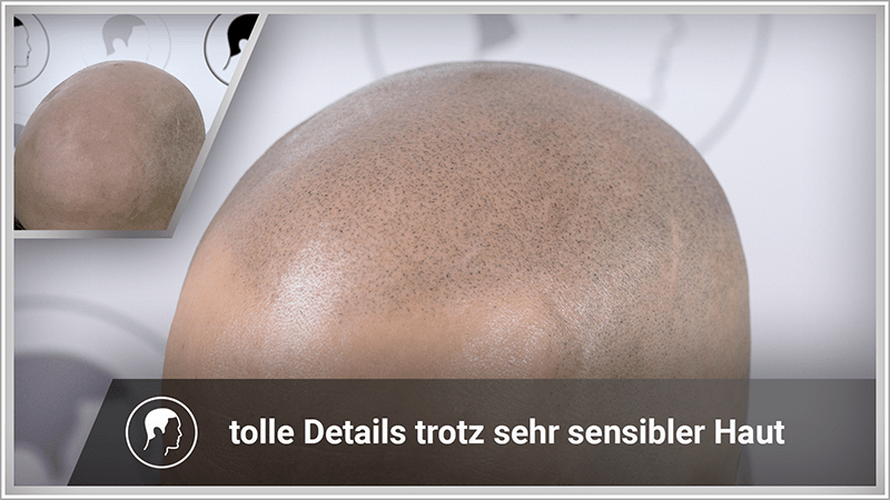 Haarpigmentierung mit tollen Details trotz sensibler Haut.
