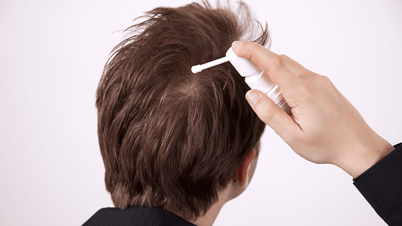 Regaine mit Minoxidil das Haarwachstum anregen