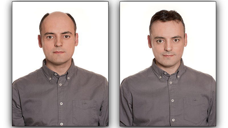 Schlecht gewähltes Toupet sieht unnatürlich aus