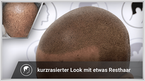 kurzrasierter Look mit etwas Resthaar