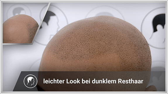 leichter Look mit dunklem Resthaar