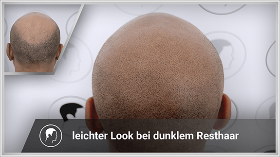 leichter Look mit dunklem Resthaar