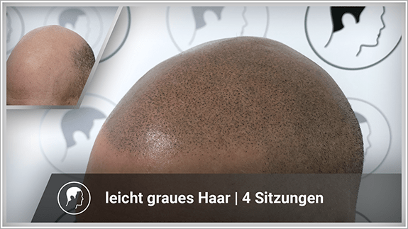 leicht graues Haar - 4 Sitzungen