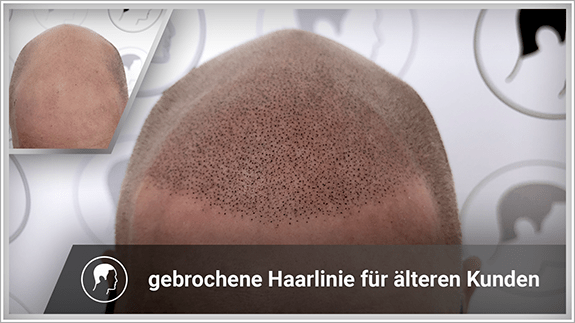 gebrochene Haarlinie für älteren Kunden