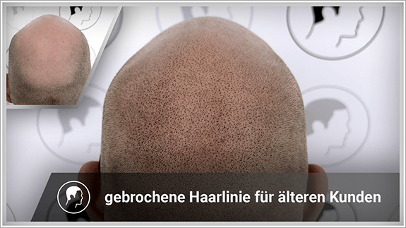 gebrochene Haarlinie für älteren Kunden