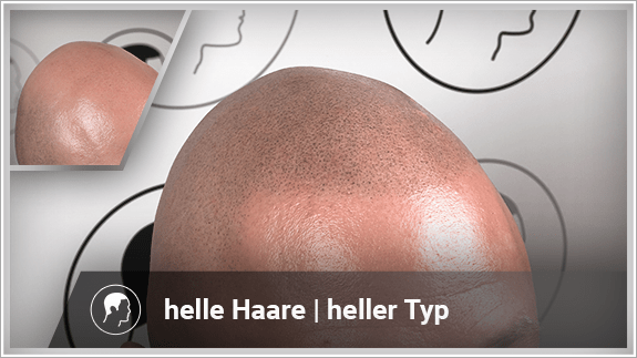 helle Haare - heller Typ
