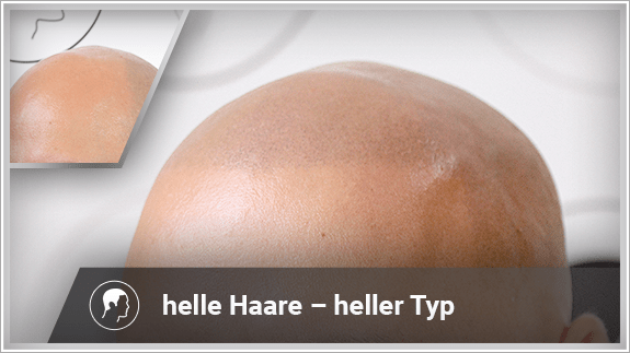 helle Haare - heller Typ