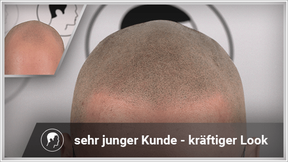 sehr junger Kunde - kräftiger Look