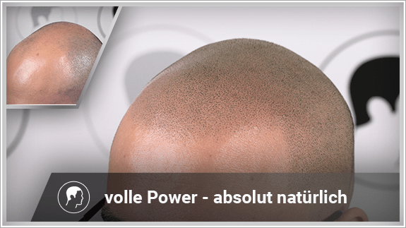volle Power - absolut natürlich