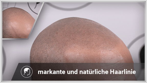 markante und natürliche Haarlinie