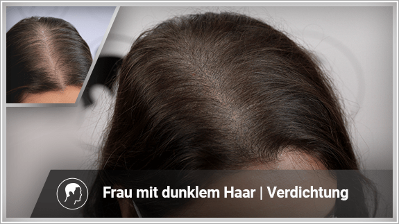 Haarverdichtung - Frau mit dunklem Haar