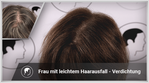 Frau mit leichtem Haarausfall - Verdichtung