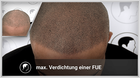 maximale Verdichtung einer FUT