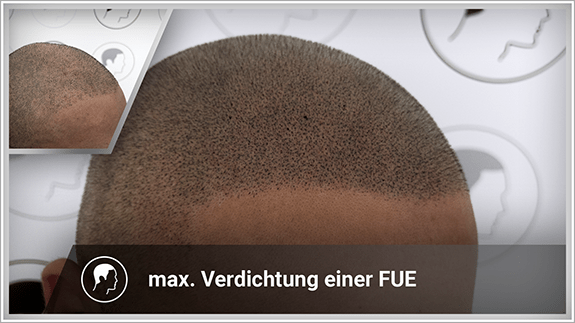 maximale Verdichtung einer FUT