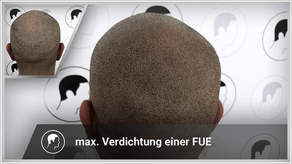 maximale Verdichtung einer FUT