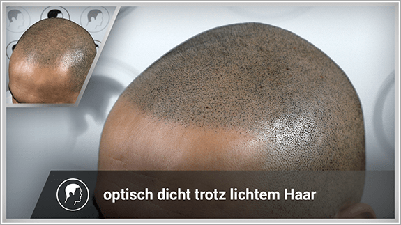 optisch dicht trotz lichtem Haar