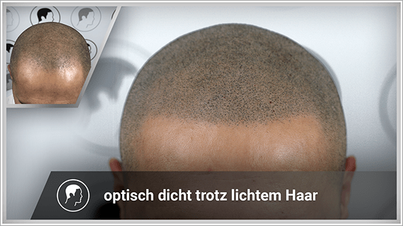 optisch dicht trotz lichtem Haar